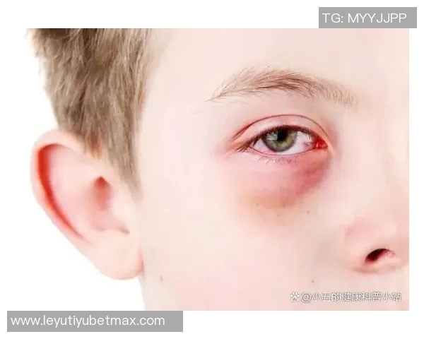 小卡解释鼻子出血原因只是轻微划伤并遭遇眼部意外碰撞